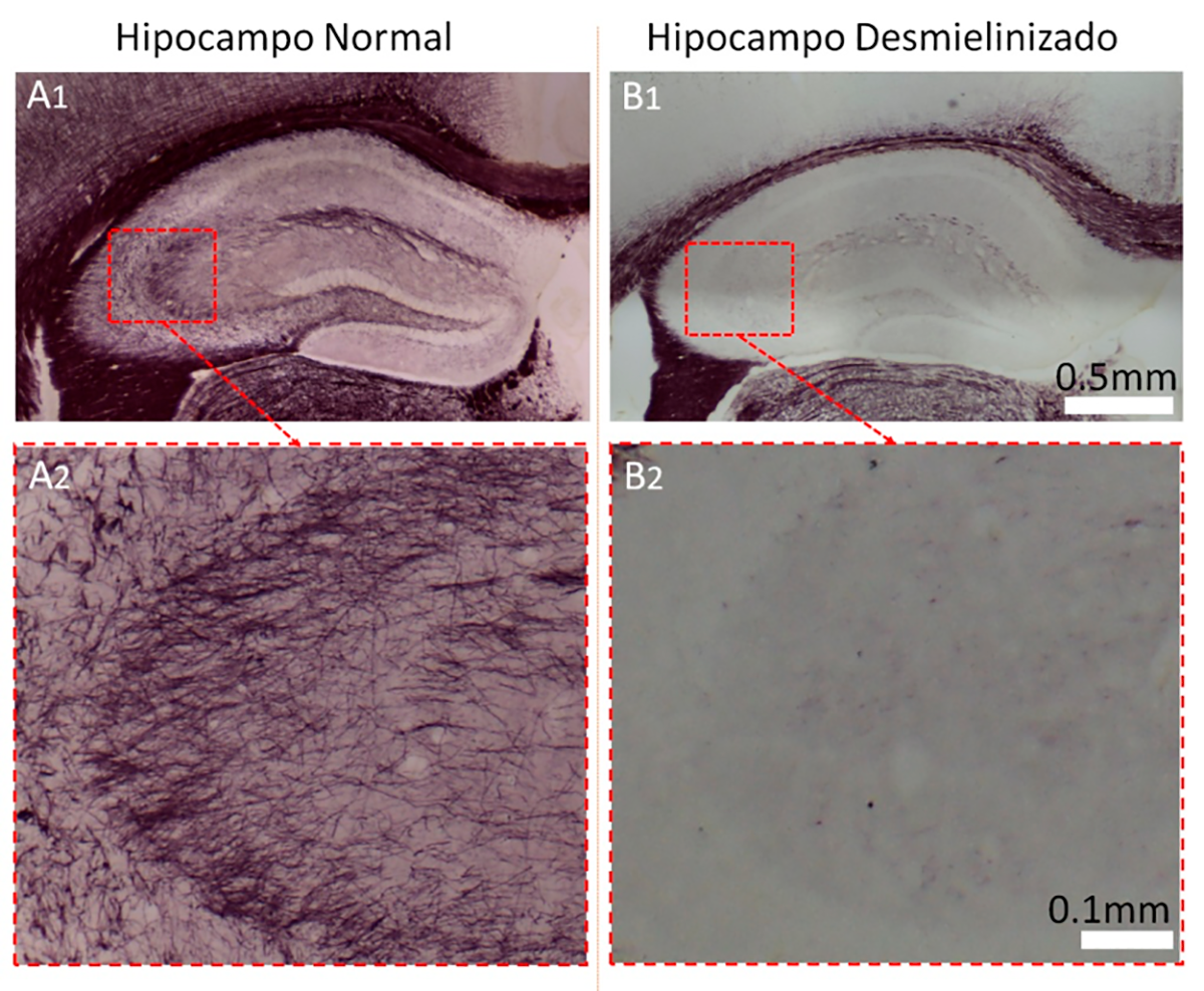 Hipocampo-C2